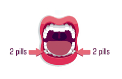 Image of a mouth with misoprostol tablets on each side between the cheek and gum.